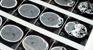 зависимости